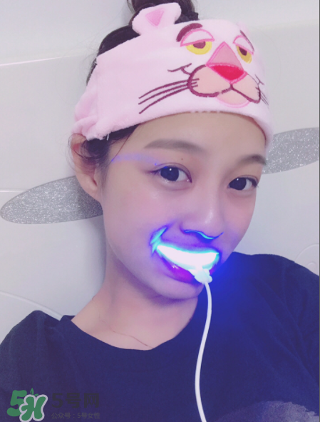 美牙儀能去牙結石嗎？美牙儀對牙結石有效嗎？