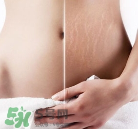 妊娠紋什么時候變白？妊娠紋產品什么時候用？