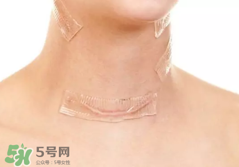 硅膠疤痕貼有用嗎？硅膠疤痕貼效果怎么樣？