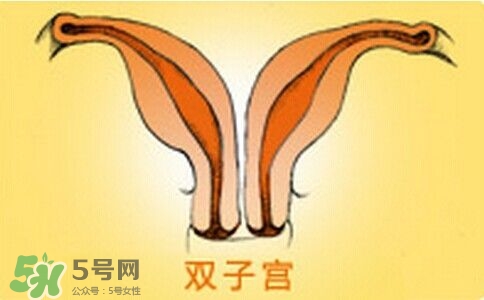 雙子宮是什么意思？雙子宮可以順產嗎？
