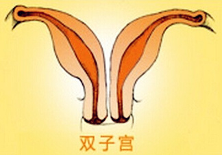 雙子宮是什么意思？雙子宮可以順產嗎？