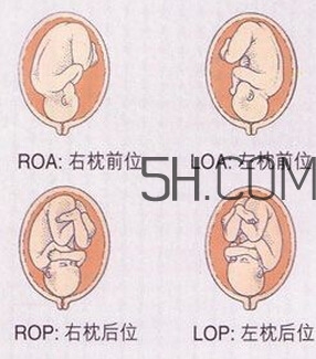 什么情況下需要剖腹產 剖腹產最全科普