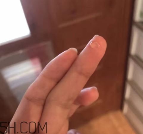 倍舒痕可以去痘印嗎？倍舒痕能涂在痘痘上嗎？