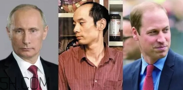 為什么會禿頂？禿頂的人聰明嗎
