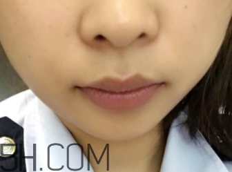 小蜜蜂細(xì)致修護唇膏很油嗎？夏天用合適嗎？