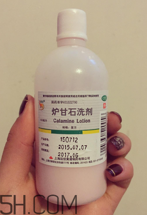 爐甘石洗劑多少錢一瓶？爐甘石洗劑治痤瘡嗎？