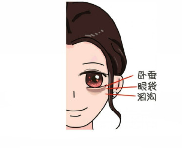 臥蠶和眼袋的區別圖片 7招小技巧掩蓋