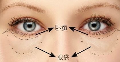 臥蠶和眼袋的區別圖片 7招小技巧掩蓋