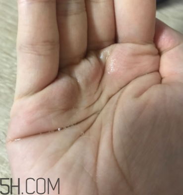 雪肌精卸妝油糊眼睛嗎？雪肌精卸妝油悶痘嗎？