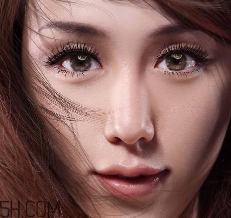 上瞼提肌手術有必要嗎？上瞼提肌后是永久的嗎？