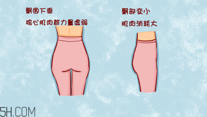 臀部護理對健康有什么影響？日常如何保養臀部健康？