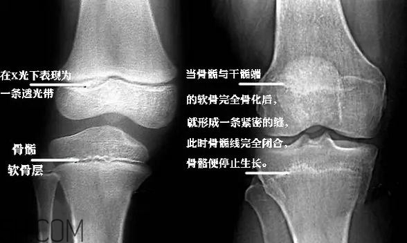 孩子學街舞好不好？學街舞好處多多
