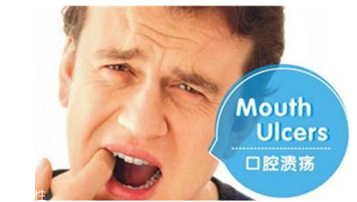 潰瘍的根源在哪里？也許僅僅只是牙膏沒選對