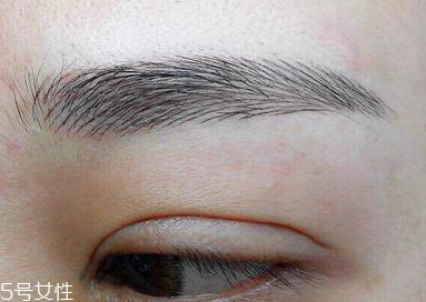 激光洗眉恢復期有疤痕怎么辦？激光洗眉毛之后正確護理方法