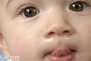 冬季寶寶流鼻涕是什么原因？教你幾招輕松應(yīng)對