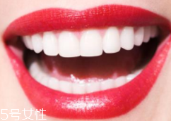 牙齒發黃是天生的嗎？只是你刷牙偷懶了