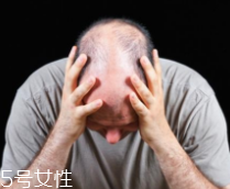 脫發有沒有治？只要不是禿子就有得治