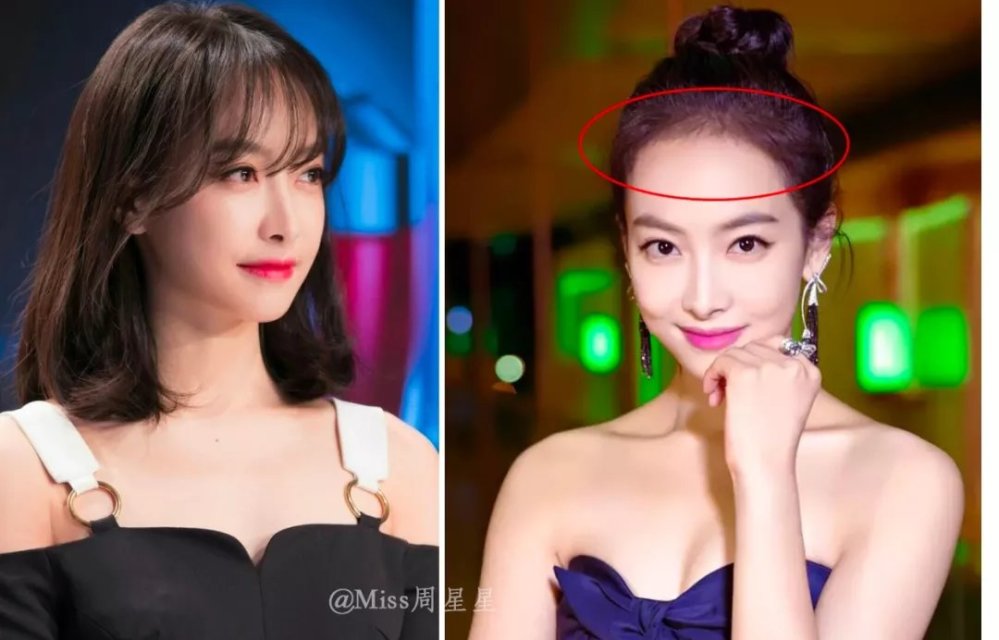 生發精華什么牌子好 5款最有效的生發精華