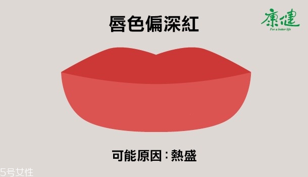 ?嘴唇發黑發紫是什么原因 6種唇色解讀