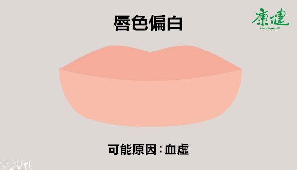?嘴唇發黑發紫是什么原因 6種唇色解讀