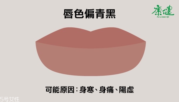 ?嘴唇發黑發紫是什么原因 6種唇色解讀
