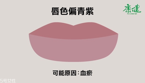 ?嘴唇發黑發紫是什么原因 6種唇色解讀