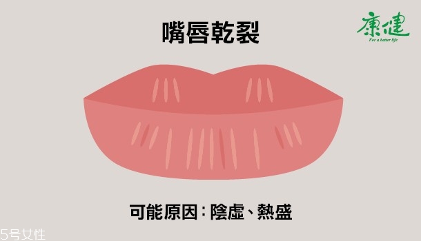 ?嘴唇發黑發紫是什么原因 6種唇色解讀