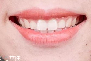 口紅病有哪些癥狀？使用不當引發癌癥
