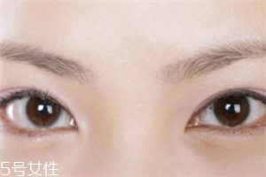 割雙眼皮后怎樣恢復快？女人不能割雙眼皮的時期