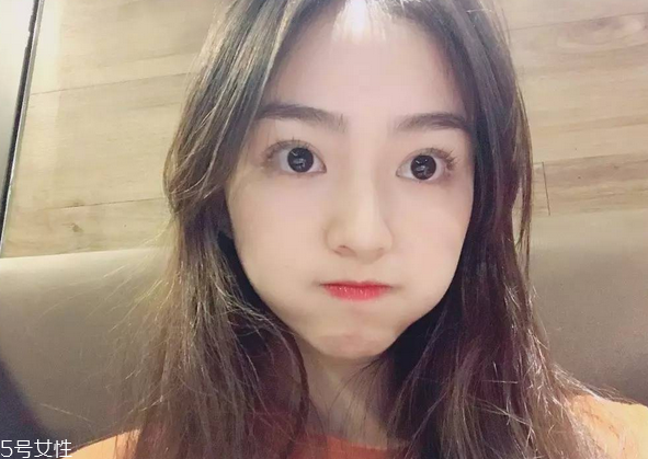 割雙眼皮要注意什么？割雙眼皮充血是正?，F象
