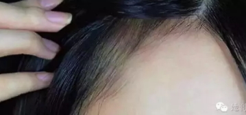 眉粉可以當發際線粉嗎？解救高發際線的技巧