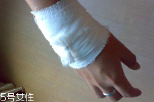 被蜈蚣咬傷后能治愈嗎？科學家有新發現