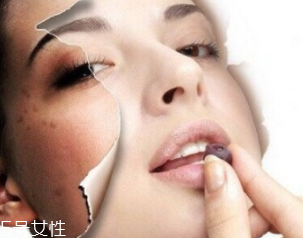 春季如何預(yù)防皮膚過敏？選擇敏感肌專用護(hù)膚品