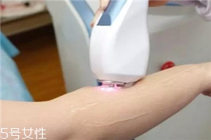 脫毛儀可以脫發際線嗎？脫了還會再長
