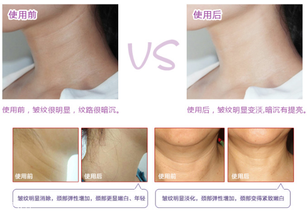 藍(lán)紫根去法令紋有用嗎 藍(lán)紫根頸膜使用測評(píng)