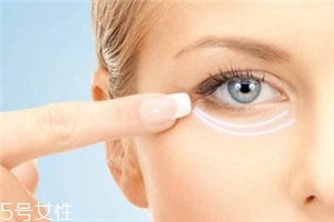 嗨體可以打淚溝嗎？嗨體填充淚溝注意事項