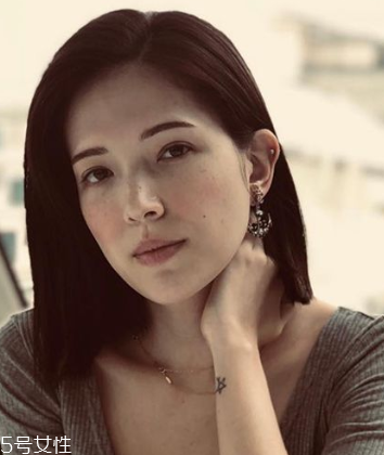 雀斑怎么去除效果好 醫美去雀斑要注意保養