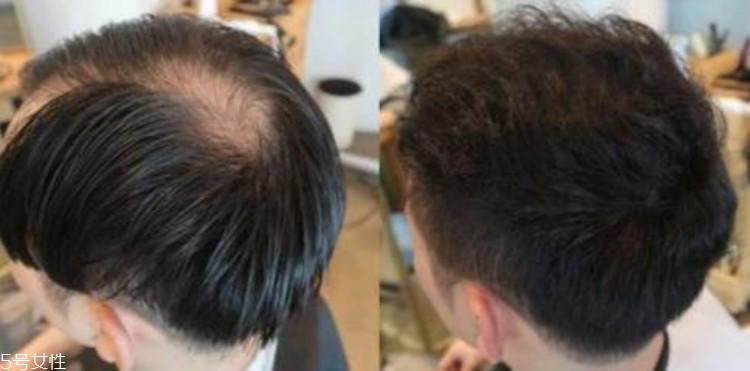 男生燙發有幾種燙法 3種基礎燙發要了解