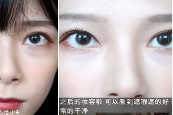 重度淚溝怎么遮瑕 4個誤區要避免