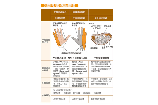手麻每天4動作 解決神經壓迫