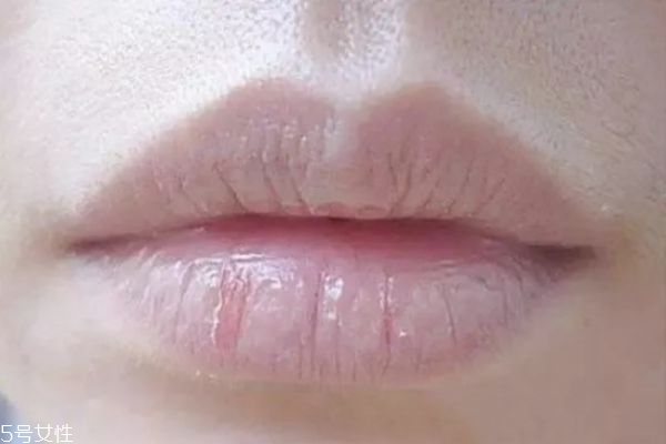 嘴唇為什么干燥 嘴唇干怎么保養