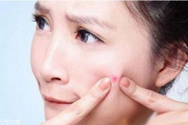 經常熬夜臉上長痘痘怎么辦 熬夜起痘痘怎么調理