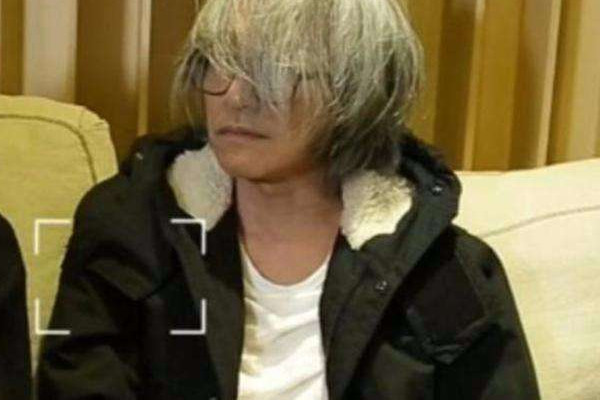 白頭發可以拔嗎 白頭發解決方法