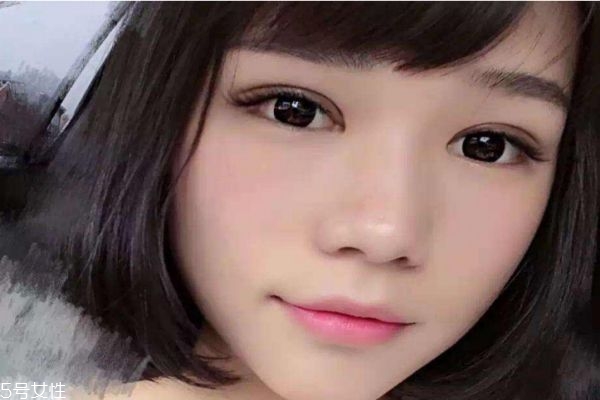 內雙割雙眼皮容易嗎 割雙眼皮有什么注意的呢
