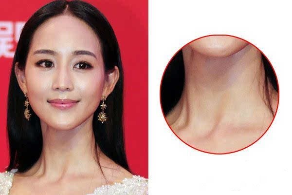 頸部日常怎么保養 預防頸部皺紋的方法哪些