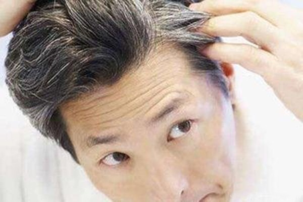 焦慮會使頭發變白嗎 頭發白可以多吃什么