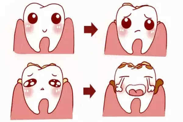 洗牙后牙齒縫隙變大怎么辦 洗牙后牙縫大怎么修補