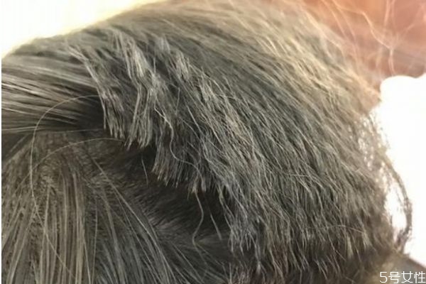 發根燙能保持多久 發根燙是什么樣子