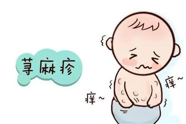 蕁麻疹老是反復發作怎么回事 蕁麻疹反復發作怎么才能根除