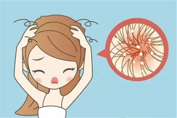 頭屑多是什么原因造成的 頭屑會影響頭發生長嗎